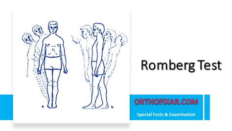 positive romberg test impacts what part of brain|romberg positive results.